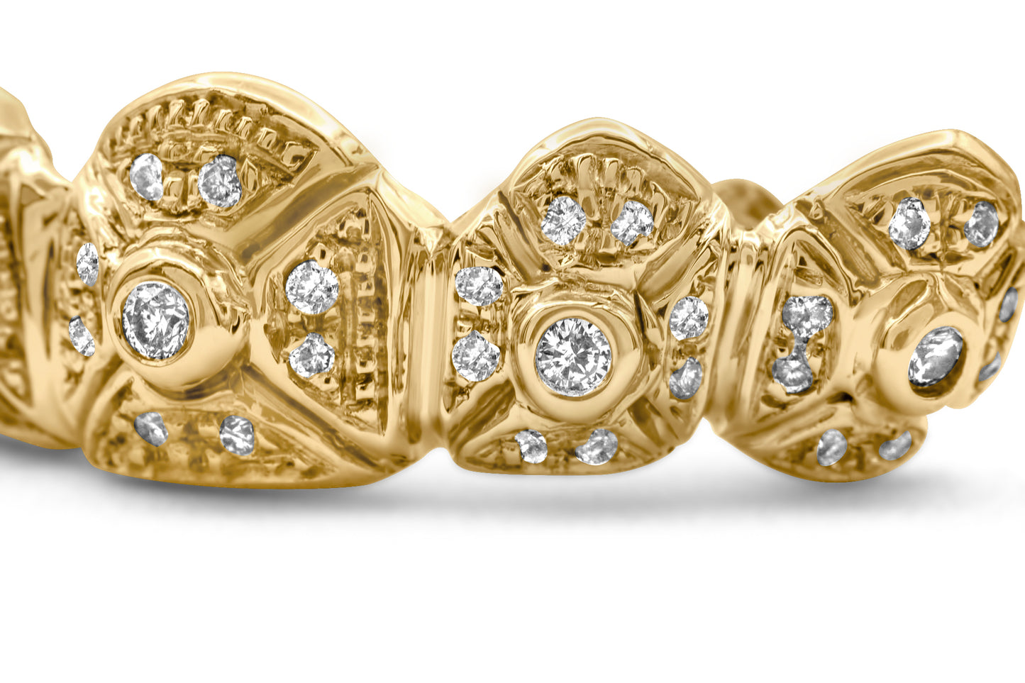 14K Yellow Gold Diamond X's (Top) Grillz